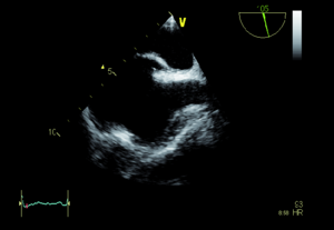 Small original ryc.3