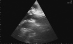 Small 5 opt