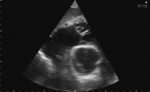 Small 7 opt