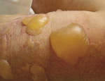 Small ryc 1 1 opt