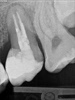 Small ryc 10 opt