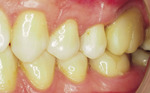 Small 13 opt
