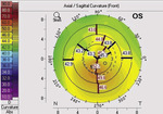 Small ryc 1 opt
