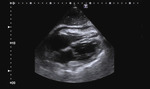 Small 1 opt