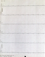 Small 9 opt