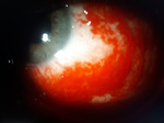 Small obraz53922 opt