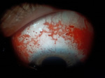 Small obraz53933 opt
