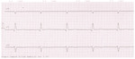 Small 1 (avr avf) opt