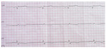 Small 2 (avr avf) opt