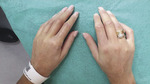 Small 3 opt