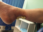 Small fot. 2. opt