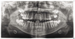 Small ryc.4 opt