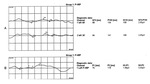 Small ryc 6 opt