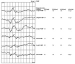Small ryc 8 opt