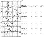 Small ryc 9 opt