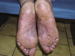 Small derm 26 ryc 1 opt