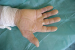 Small derm 26 ryc 2 opt