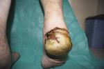 Small derm 26 ryc 3 opt