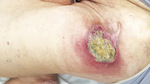 Small derm 59 rycina 1 opt