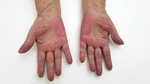 Small derm 59 rycina 2 opt