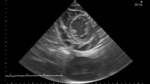 Small 7 opt