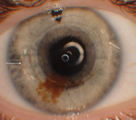 Small ryc.1 opt