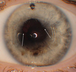 Small ryc.3 opt