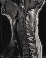 Small ryc1 1 opt