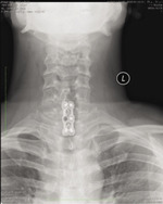 Small ryc2 opt