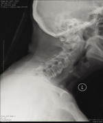 Small ryc3 opt