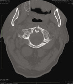 Small ryc4 opt