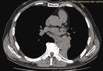 Small ryc1 1 opt