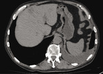 Small ryc2 1 opt
