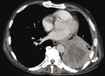 Small ryc3 1 opt