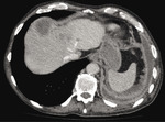 Small ryc4 opt