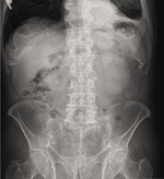 Small ryc6 opt