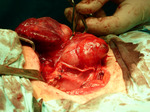 Small ryc. 5. nerw krtaniowy opt