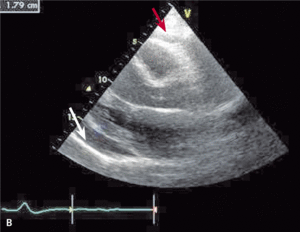 Small ryc.3b