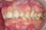 Small ryc 1 opt