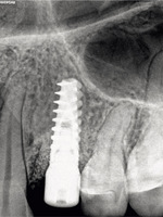Small ryc 12 opt