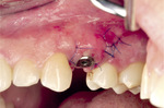 Small ryc 13 opt