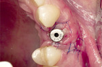 Small ryc 14 opt