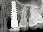 Small ryc 15 opt