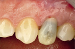 Small ryc 16 opt