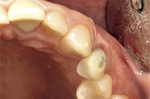 Small ryc 17 opt