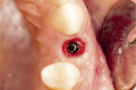 Small ryc 18 opt