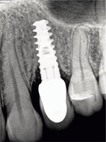Small ryc 2 opt