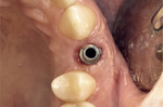 Small ryc 20 opt