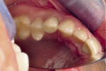 Small ryc 21 opt