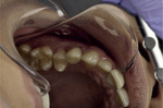 Small ryc 25 opt